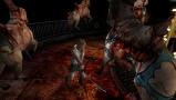 Bild 4 zu Silent Hill HD Collection