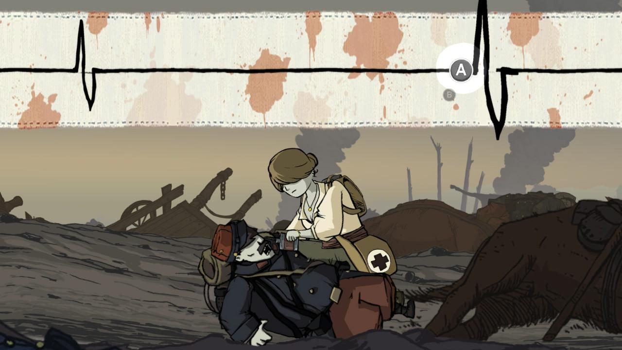 [14/11/2018] Helft ihr als Anna Verwundeten, müsst ihr in solchen Reaktionsspielchen im richtigen Moment die angezeigte Taste drücken. (Nintendo Switch)