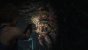 Resident Evil 3 ist teilweise purer Terror. Hier muss Protagonistin Jill schnell durch das verwinkelte Nest dieser possierlichen Tierchen kommen.